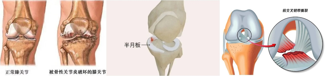 且行且珍“膝”，莫道老来空叹“膝”