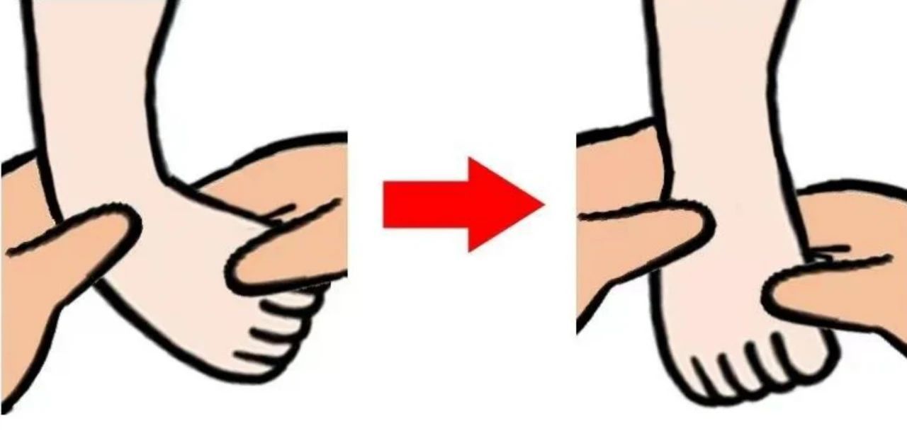 马蹄足内翻:你需要了解的病因、症状与治疗