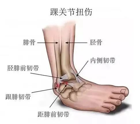 骨科科普——关“踝”备至