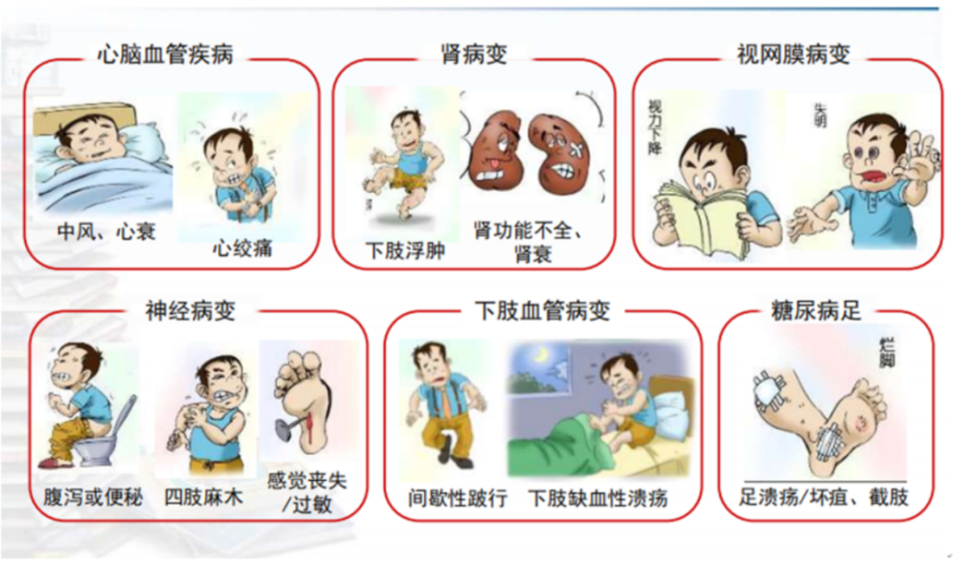 带您认识沉默的杀手——糖尿病